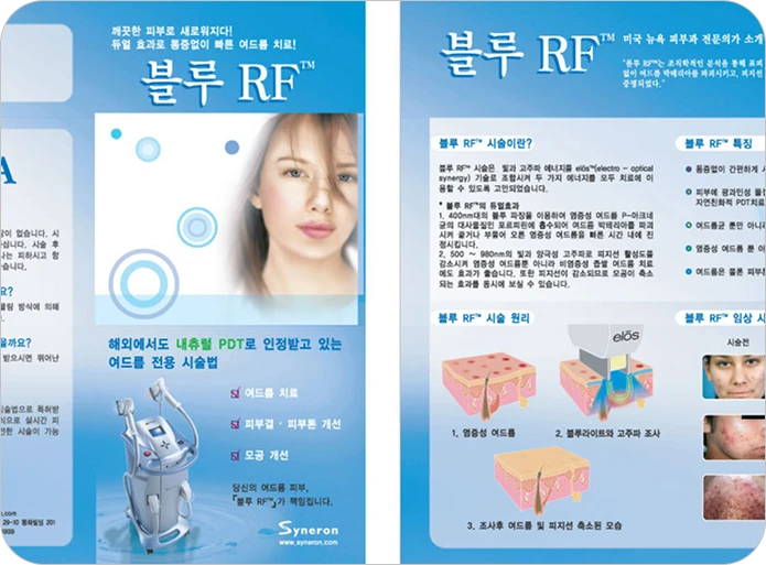 블루RF 시술 02