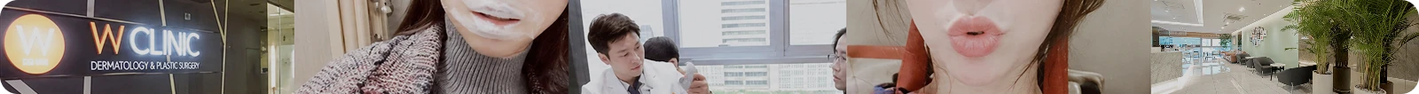 입술필러 후기