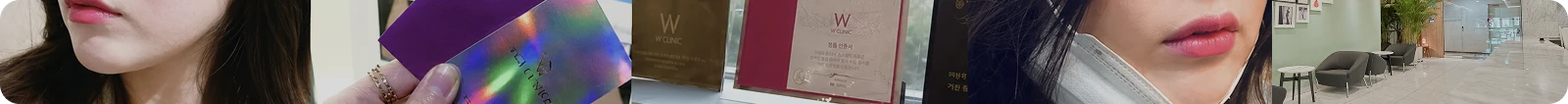 종아리보톡스 후기