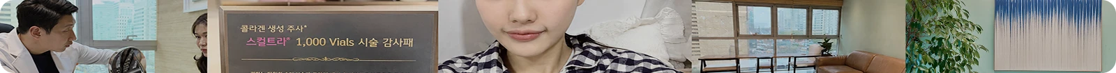 종아리보톡스 후기