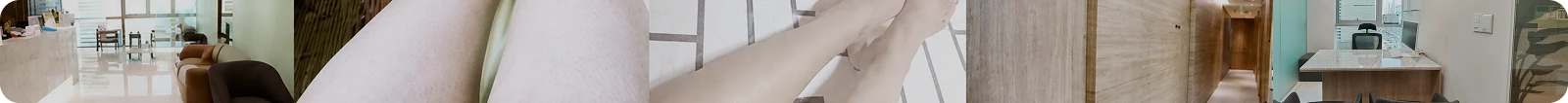 다리 제모 후기