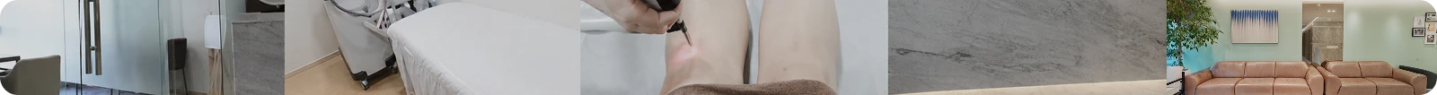 제모 후기
