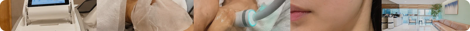 온다 리프팅 후기