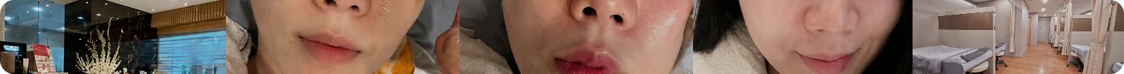 온다 리프팅 후기