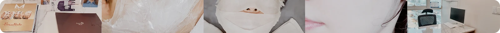 시크릿RF 후기