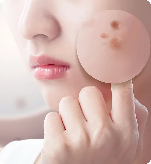 Whitening Care | 미백 관리