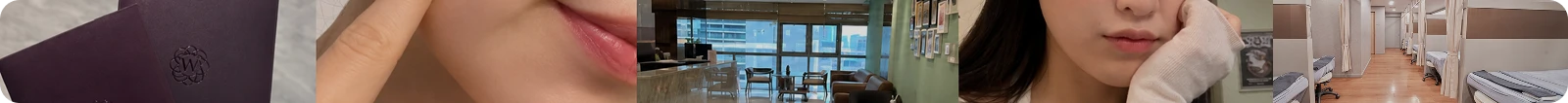 써마지 리프팅 후기