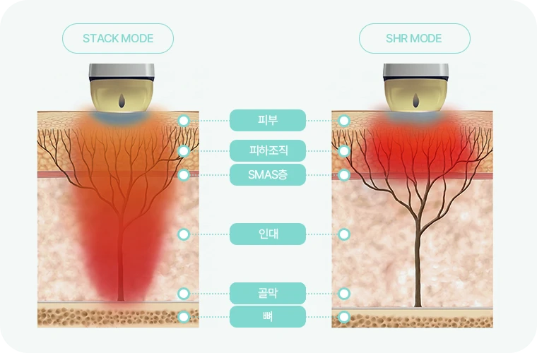 2가지 모드