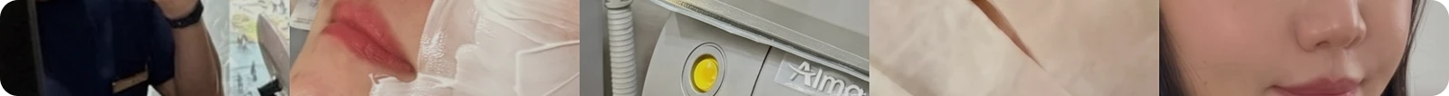 티타늄 리프팅 후기