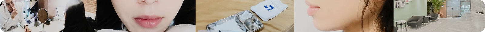 종아리보톡스 후기